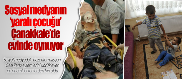 Sosyal medyanın ‘yaralı çocuğu’ evinde oynuyor