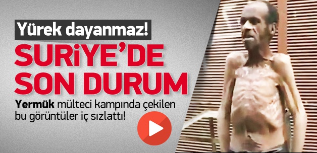 Bu görüntüye yürek dayanmaz!