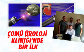 ÇOMÜ Üroloji Kliniği’nde Bir İlk