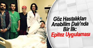 Göz Hastalıkları Anabilim Dalı’nda Bir İlk: Epitez Uygulaması
